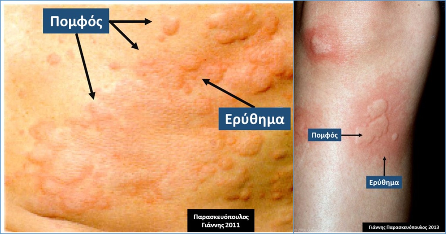 Σύρετε το ποντίκι πάνω στην εικόνα για zoom